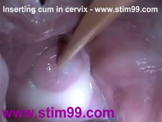 Cervical Sperm Insertion Widely Stretching Pussy Mirror